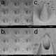 Microneedles