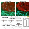 เปรียบเทียบภาพจากกล้อง Confocal และ Widefield Fluorescence Microscopy