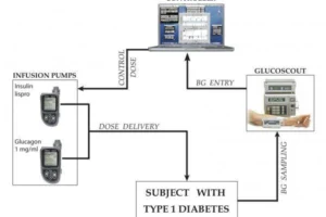 แผนผังการทำงานของตับอ่อนเทียม