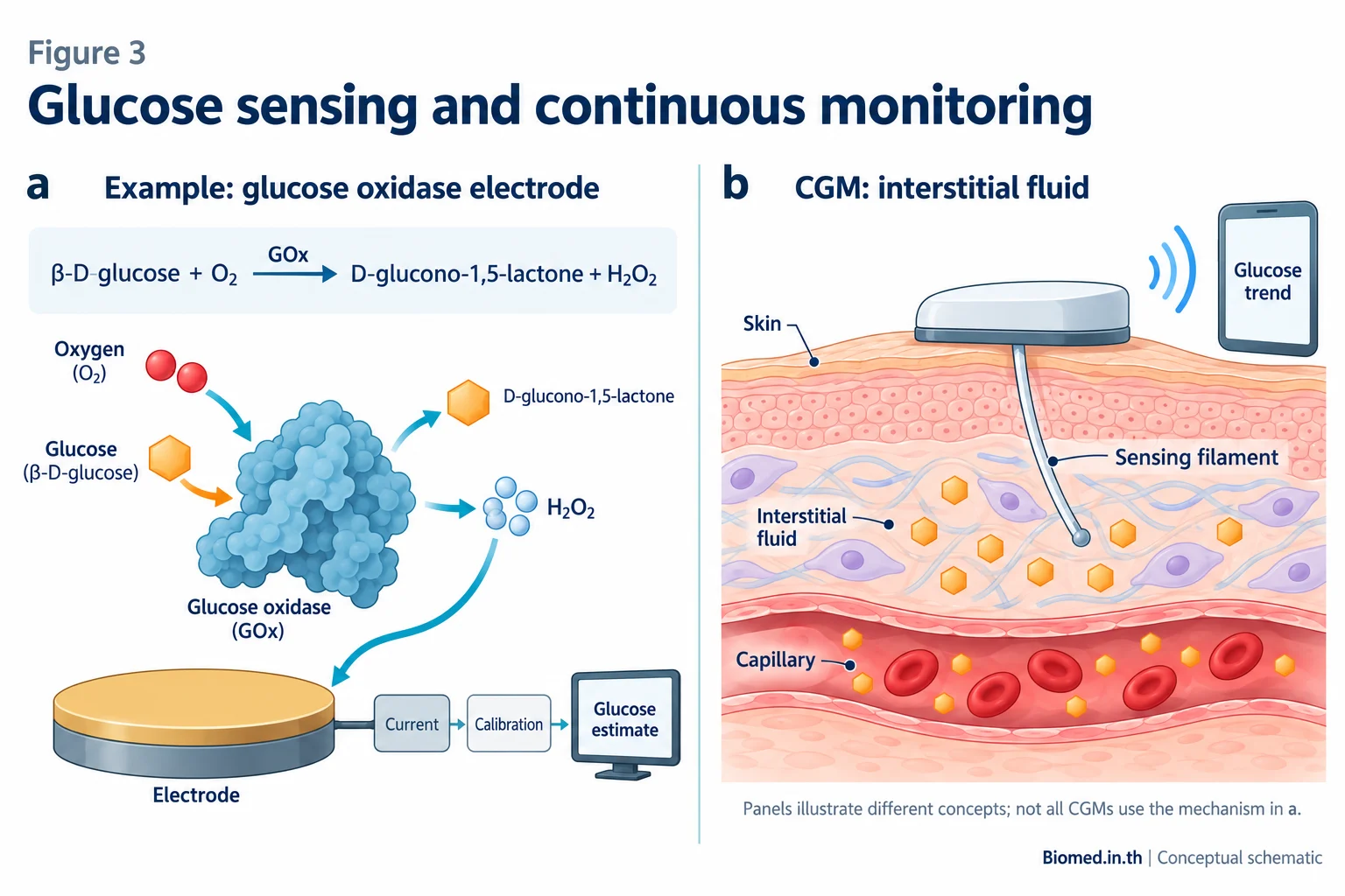 กลไก glucose oxidase และตำแหน่งปลายเซนเซอร์ CGM ในของเหลวระหว่างเซลล์นอกหลอดเลือด