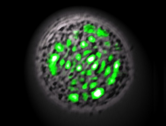 แสงแห่งชีวิต ภาพถ่ายจากกล้องจุลทรรศ์แสดงให้เห็นแสงเลเซอร์สีเขียวที่เปล่งออกมาจากเซลล์สิ่งมีชีวิต Credit: Malte Gather