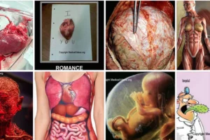 Medical Videos