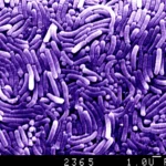 ภาพ SEM แต่งสีม่วงของกลุ่มแบคทีเรีย Helicobacter รูปร่างแท่งโค้ง พร้อมแถบมาตราส่วน 1 ไมโครเมตร