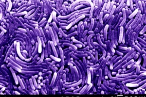 ภาพ SEM แต่งสีม่วงของกลุ่มแบคทีเรีย Helicobacter รูปร่างแท่งโค้ง พร้อมแถบมาตราส่วน 1 ไมโครเมตร
