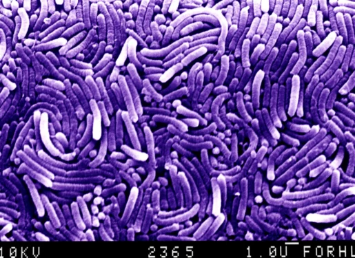 ภาพ SEM แต่งสีม่วงของกลุ่มแบคทีเรีย Helicobacter รูปร่างแท่งโค้ง พร้อมแถบมาตราส่วน 1 ไมโครเมตร