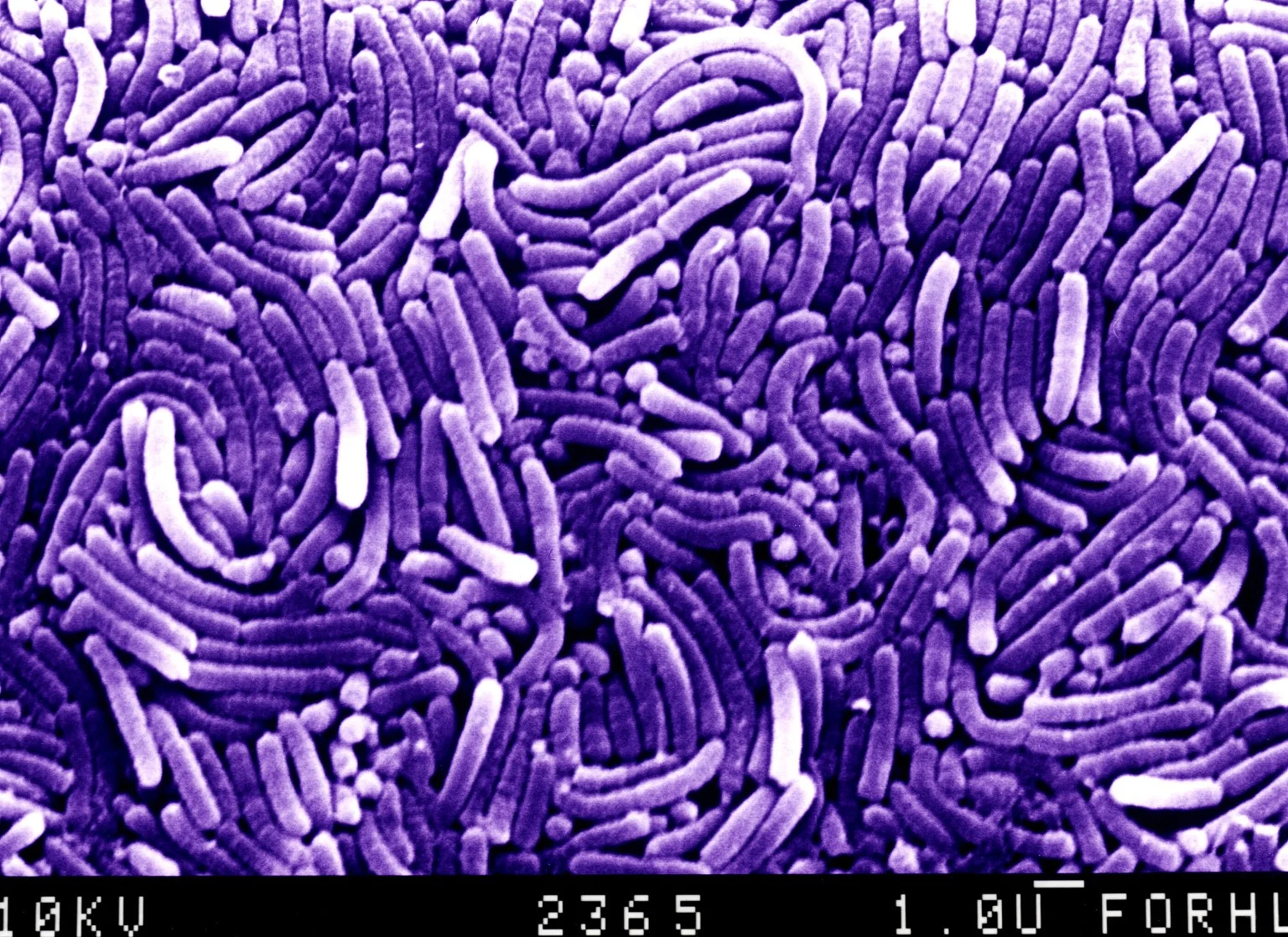 ภาพ SEM แต่งสีม่วงของกลุ่มแบคทีเรีย Helicobacter รูปร่างแท่งโค้ง พร้อมแถบมาตราส่วน 1 ไมโครเมตร